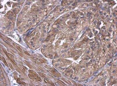 Immunohistochemistry-Paraffin: UbcH5a/UBE2D1 Antibody [NBP1-32734]