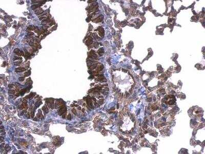Immunohistochemistry-Paraffin: UbcH5a/UBE2D1 Antibody [NBP1-32734]