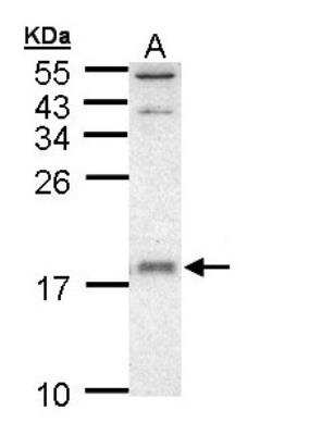 Western Blot: UbcH5a/UBE2D1 Antibody [NBP1-32734]