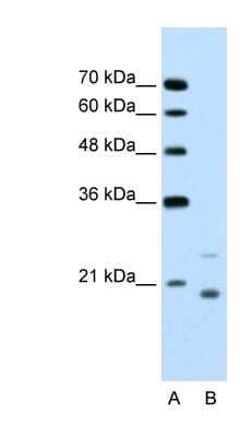 Western Blot: UbcH5a/UBE2D1 Antibody [NBP1-55033]