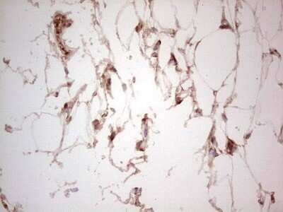 Immunohistochemistry: UbcH5b/UBE2D2 Antibody (OTI2C2) [NBP2-46270]