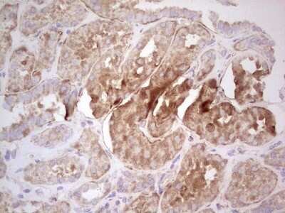 Immunohistochemistry: UbcH5b/UBE2D2 Antibody (OTI2C2) [NBP2-46270]