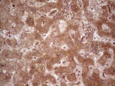 Immunohistochemistry: UbcH5b/UBE2D2 Antibody (OTI2C2) [NBP2-46270]