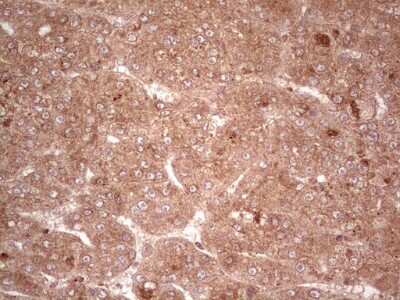 Immunohistochemistry: UbcH5b/UBE2D2 Antibody (OTI2C2) [NBP2-46270]