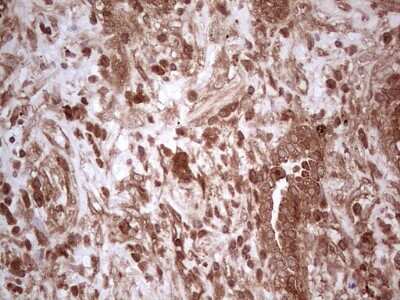 Immunohistochemistry: UbcH5b/UBE2D2 Antibody (OTI2C2) [NBP2-46270]