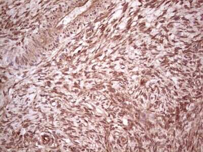 Immunohistochemistry: UbcH5b/UBE2D2 Antibody (OTI2C2) [NBP2-46270]