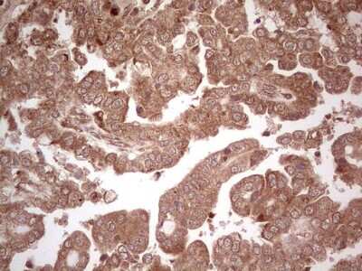 Immunohistochemistry: UbcH5b/UBE2D2 Antibody (OTI2C2) [NBP2-46270]