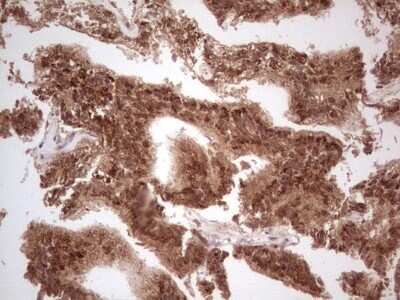 Immunohistochemistry: UbcH5b/UBE2D2 Antibody (OTI2C2) [NBP2-46270]