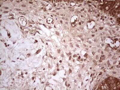 Immunohistochemistry: UbcH5b/UBE2D2 Antibody (OTI2C2) [NBP2-46270]