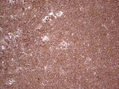 Immunohistochemistry: UbcH5b/UBE2D2 Antibody (OTI2C2) [NBP2-46270]