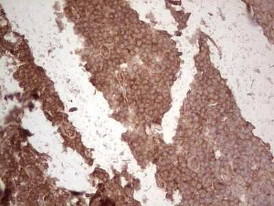 Immunohistochemistry: UbcH5b/UBE2D2 Antibody (OTI2C2) [NBP2-46270]