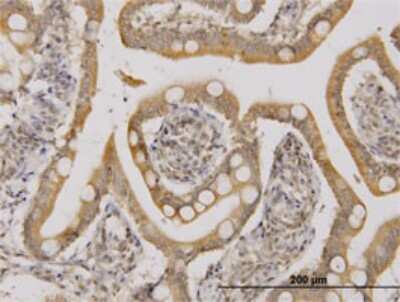 Immunohistochemistry-Paraffin: UbcH5b/UBE2D2 Antibody (4A1) [H00007322-M02]