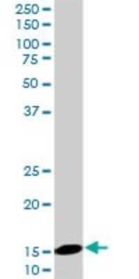 Western Blot: UbcH5b/UBE2D2 Antibody (4A1) [H00007322-M02]
