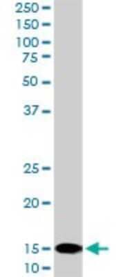 Western Blot: UbcH5b/UBE2D2 Antibody (4A1) [H00007322-M02]