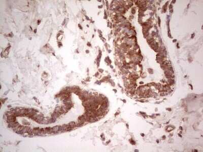 Immunohistochemistry: UbcH5b/UBE2D2 Antibody (OTI2C2) - Azide and BSA Free [NBP2-74732]