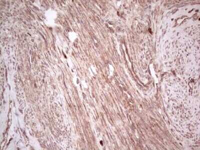 Immunohistochemistry: UbcH5b/UBE2D2 Antibody (OTI2C2) - Azide and BSA Free [NBP2-74732]