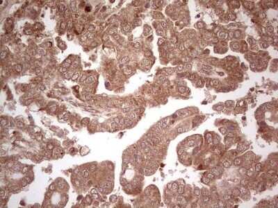 Immunohistochemistry: UbcH5b/UBE2D2 Antibody (OTI2C2) - Azide and BSA Free [NBP2-74732]