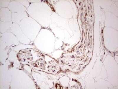 Immunohistochemistry: UbcH5b/UBE2D2 Antibody (OTI2C2) - Azide and BSA Free [NBP2-74732]