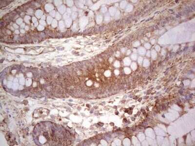 Immunohistochemistry: UbcH5b/UBE2D2 Antibody (OTI2C2) - Azide and BSA Free [NBP2-74732]