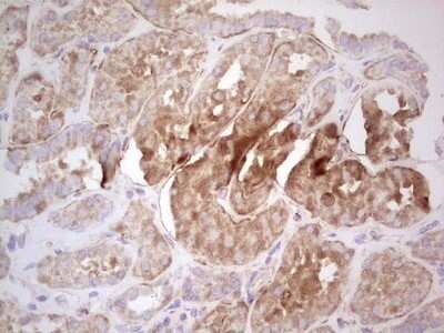 Immunohistochemistry: UbcH5b/UBE2D2 Antibody (OTI2C2) - Azide and BSA Free [NBP2-74732]