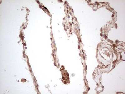Immunohistochemistry: UbcH5b/UBE2D2 Antibody (OTI2C2) - Azide and BSA Free [NBP2-74732]
