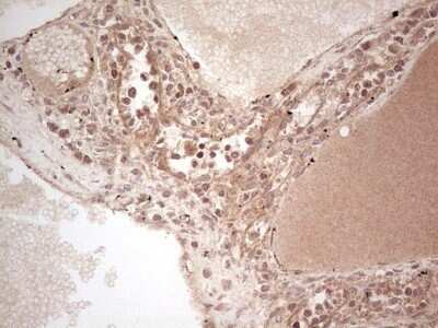 Immunohistochemistry: UbcH5b/UBE2D2 Antibody (OTI2C2) - Azide and BSA Free [NBP2-74732]