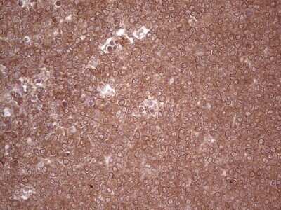 Immunohistochemistry: UbcH5b/UBE2D2 Antibody (OTI2C2) - Azide and BSA Free [NBP2-74732]