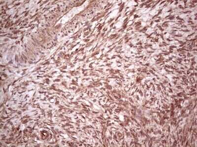 Immunohistochemistry: UbcH5b/UBE2D2 Antibody (OTI2C2) - Azide and BSA Free [NBP2-74732]