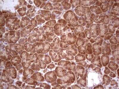 Immunohistochemistry: UbcH5b/UBE2D2 Antibody (OTI2C2) - Azide and BSA Free [NBP2-74732]