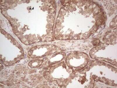 Immunohistochemistry: UbcH5b/UBE2D2 Antibody (OTI2C2) - Azide and BSA Free [NBP2-74732]