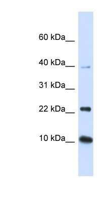 Western Blot: UbcH5b/UBE2D2 Antibody [NBP1-55275]