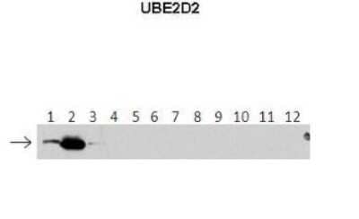 Western Blot: UbcH5b/UBE2D2 Antibody [NBP1-55275]