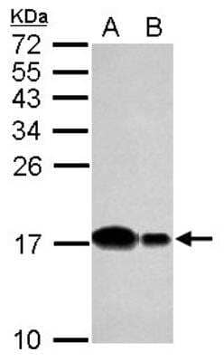 Western Blot: UbcH5b/UBE2D2 Antibody [NBP2-20783]