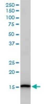 Western Blot: UbcH5c/UBE2D3 Antibody (4C1-1E3) [H00007323-M01]