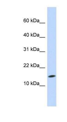 Western Blot: UbcH5c/UBE2D3 Antibody [NBP1-55276]