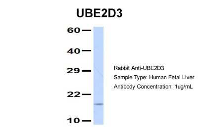 Western Blot: UbcH5c/UBE2D3 Antibody [NBP1-55276]