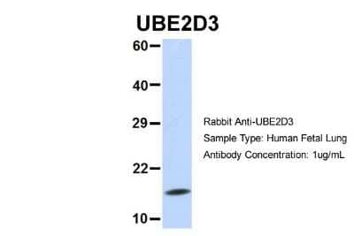 Western Blot: UbcH5c/UBE2D3 Antibody [NBP1-55276]