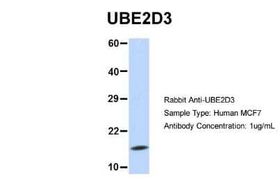 Western Blot: UbcH5c/UBE2D3 Antibody [NBP1-55276]