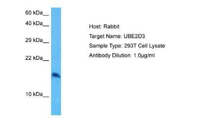 Western Blot: UbcH5c/UBE2D3 Antibody [NBP2-82368]