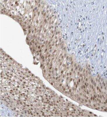 Immunohistochemistry-Paraffin: UbcH6/UBE2E1 Antibody [NBP1-86886]