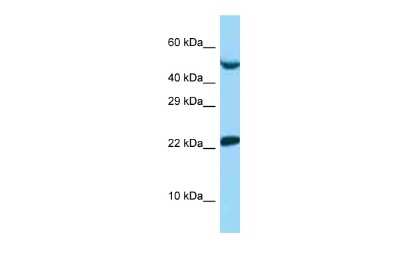 Western Blot: UbcH6/UBE2E1 Antibody [NBP2-86036]