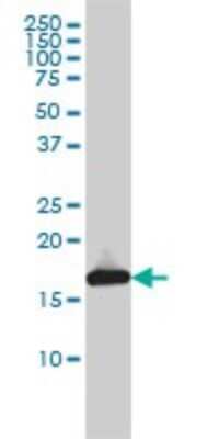 Western Blot: UbcH7/UBE2L3 Antibody (3B7) [H00007332-M01]