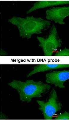Immunocytochemistry/ Immunofluorescence: UbcH7/UBE2L3 Antibody [NBP1-30995]