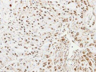 Immunohistochemistry-Paraffin: UbcH7/UBE2L3 Antibody [NBP1-30995]