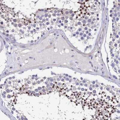 Immunohistochemistry-Paraffin: UbcH7/UBE2L3 Antibody [NBP1-92557]