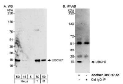 Western Blot: UbcH7/UBE2L3 Antibody [NB100-2265]