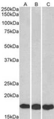 Western Blot: UbcH7/UBE2L3 Antibody [NB300-841]