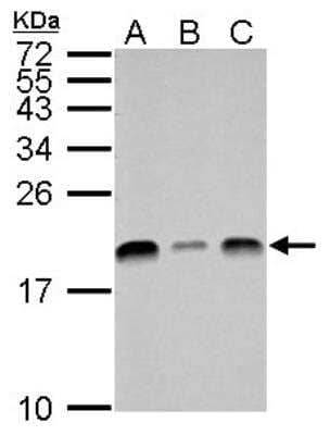 Western Blot: UbcH7/UBE2L3 Antibody [NBP1-30995]
