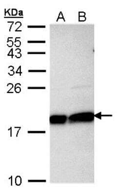 Western Blot: UbcH7/UBE2L3 Antibody [NBP1-30995]