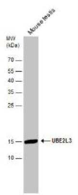 Western Blot: UbcH7/UBE2L3 Antibody [NBP1-30995]